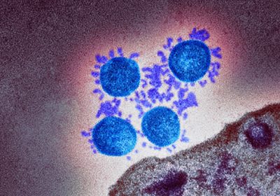 Koronavirusas (COVID-19) – ką reikia žinoti